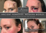 The Alchemist Collection All natural Wound Repair four real examples of wounds it could treat